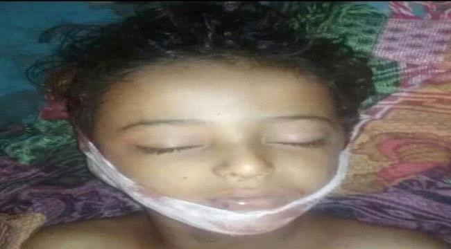 استشهاد طفلة وإصابة 3 آخرين من عائلة واحدة بنيران #الحـوثي شمال #الضـالع