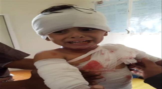 إصابة طفلين بشظايا قذيفة حوثية بالبيضاء