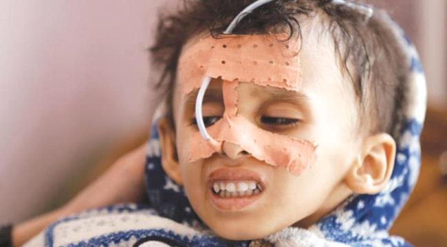 آلاف الأطفال بمرمى قذائف #الحـوثي.. يواجهون الموت