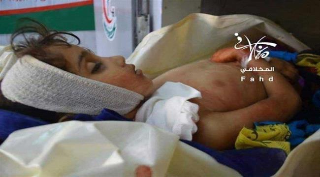 قذيفة حوثية تتسبب في اصابة طفلة ب#تعـز 