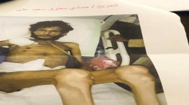 الشرعية تعاقب الجرحى الجنوبيين بالموت