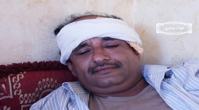 قناص حوثي يستهدف مواطن بطلقة اصابته برأسه في منطقة حجر #الضـالع