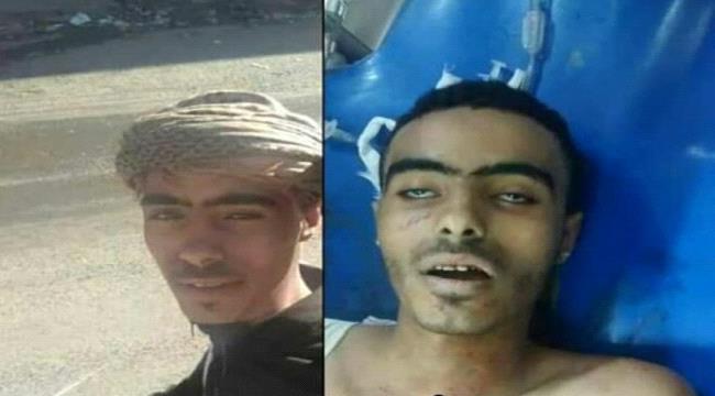 عصابة تابعة لمليشيا الإخوان تقتل شاباً بمنطقة عصيفرة بتعز