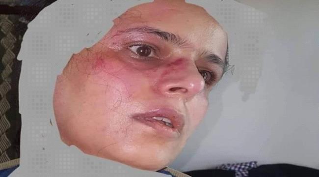 لانتقادها سياساتهم..مليشيات الحوثي تُعذب ناشطة في منزلها بحجة