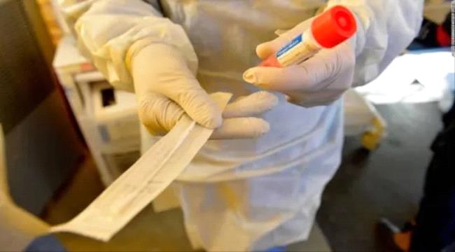 فيروس جديد بروسيا يثير قلقًا عالميًا