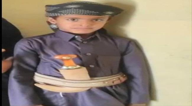 وفاة طفل في شبوة بعضّة قط يُشتبه بإصابته بالسعار