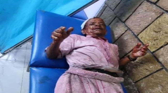 حوثي يحرق بائع مسن بالزيت المغلي في إب اليمنية